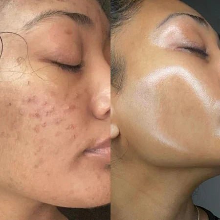 Masque Coréen au Collagène