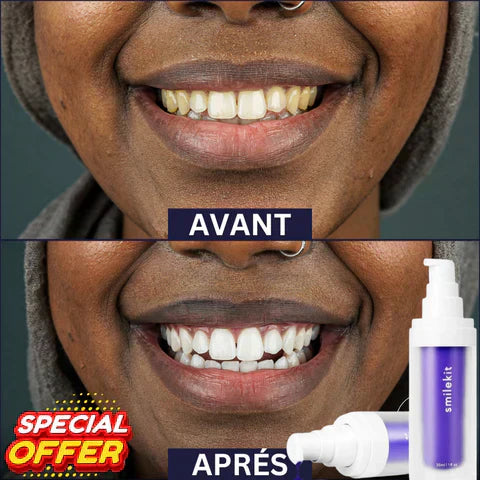 Smilekit V34 Sérum Correcteur / Dentifrice Blanchiment Dentaire 🦷