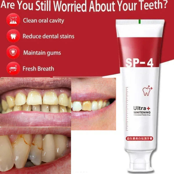 Dentifrice blanchissant probiotique SP-4  Gestion de la santé bucco-dentaire(Élimine des années de taches)
