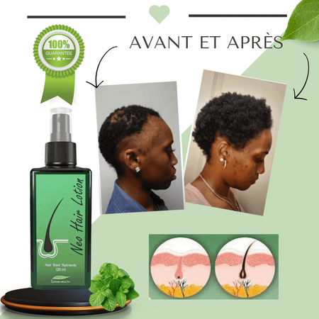 Obtenez des cheveux plus épais et en meilleure santé dès aujourd'hui! grâce a notre Spray